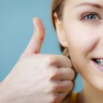 Dentist and orthodontist concept. Young woman teen girl smiling showing teeth with braces making thumb up hand sign gesture on blue